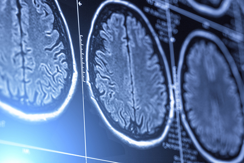 neurology