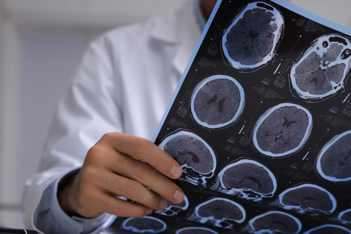 Doctor examining MRI images of patient