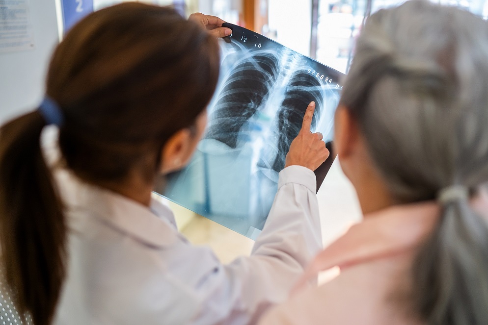 A doctor and patient look at the x-rays from a lung screening