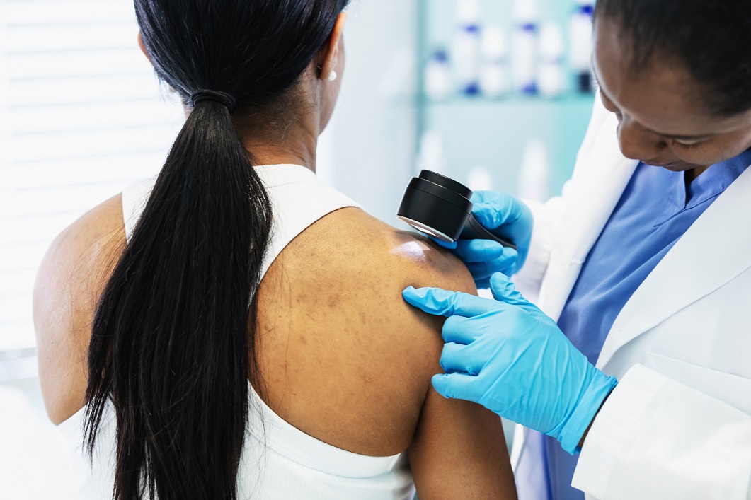 A doctor does a skin check on a patient