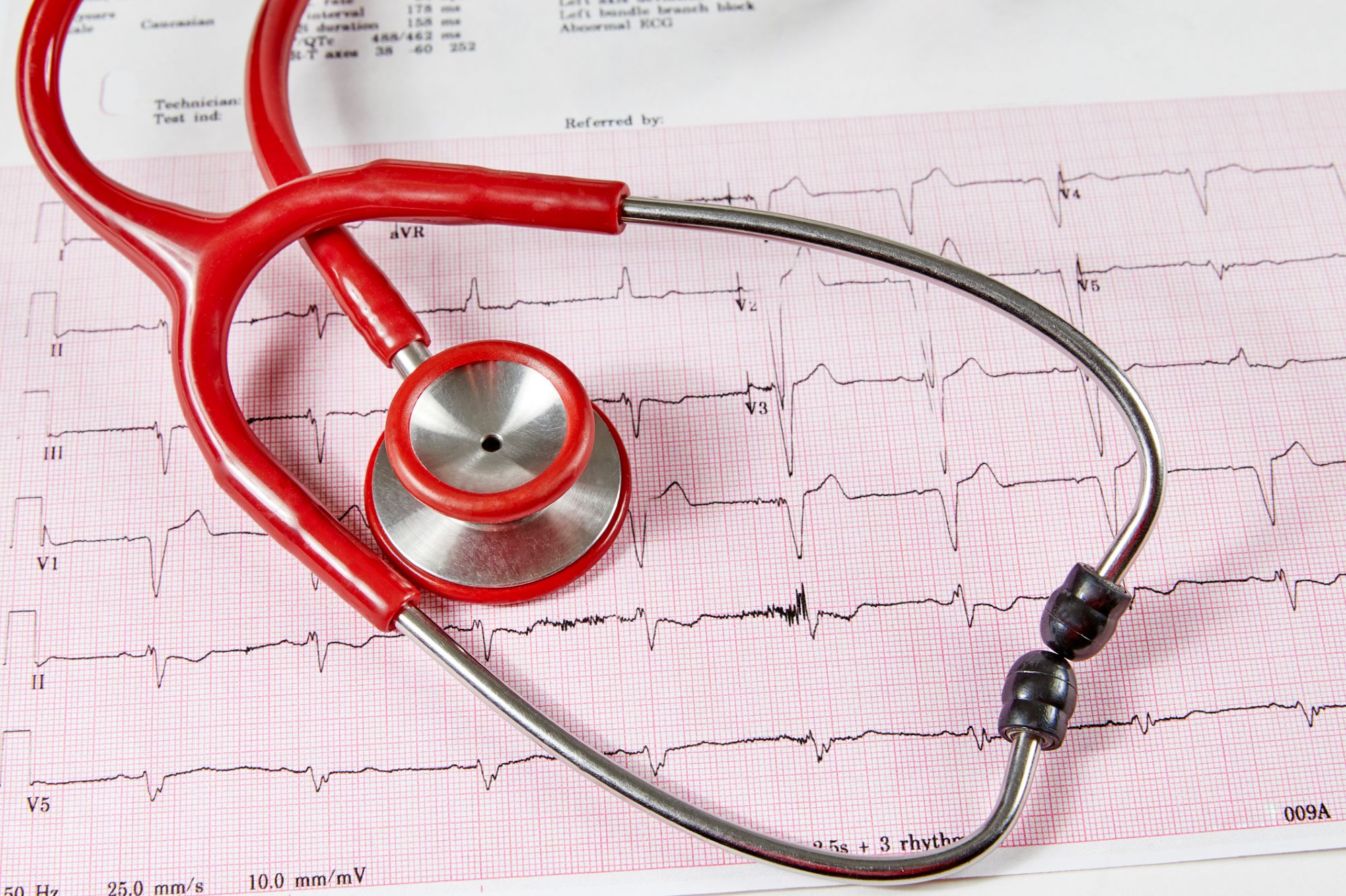 Red Stethoscope on an electrocardiogram